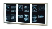 Διαφανοσκόπιο επιτοίχιο Ultra Slim Weiko Led Plus 3 θέσεων 